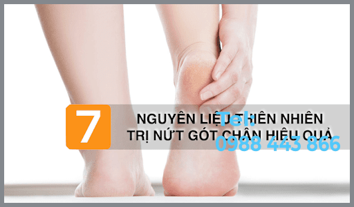 Mẹo chữa nứt gót chân bằng nguyên liệu tự nhiên